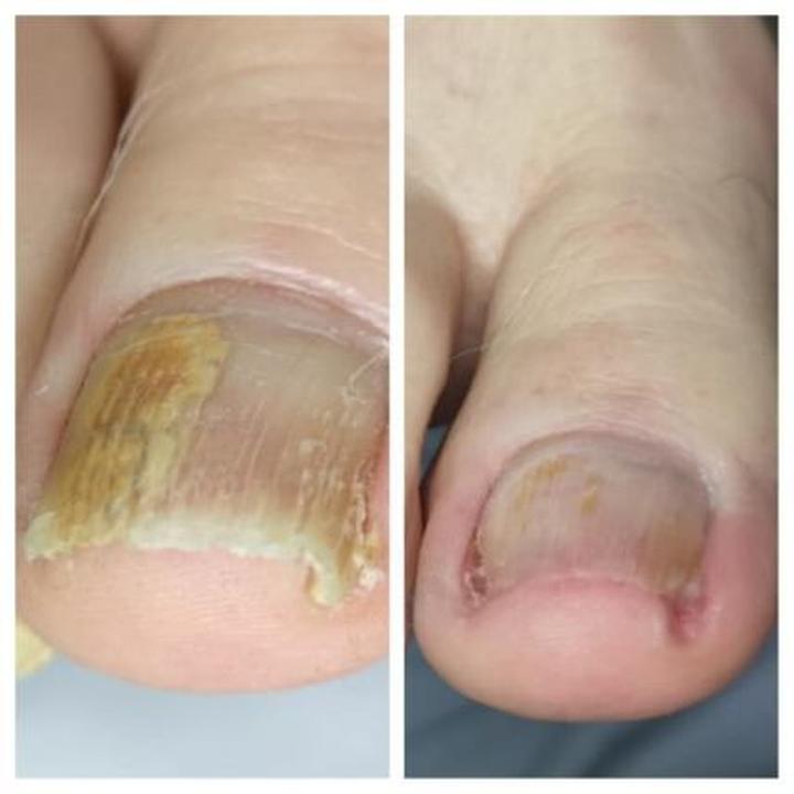 Bezpieczeństwo higieny paznokci