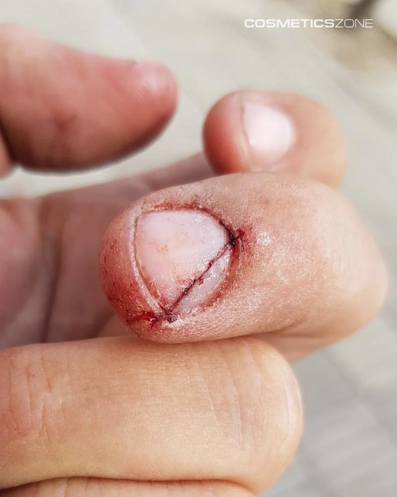 Dieta wspierająca zdrowe paznokcie